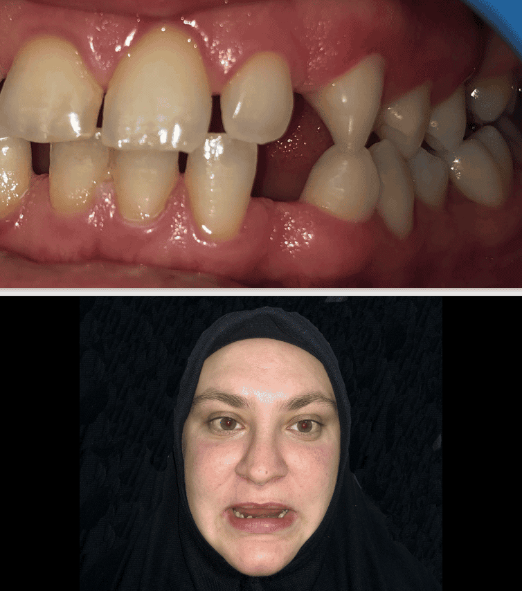 ADATIP Hospital Plastic Surgery In Sakarya Turkey