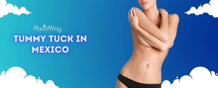 Tummy Tuck in Mexico - Mexico Cosmetic Center