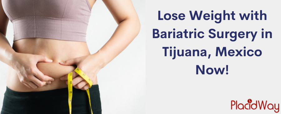 Post Bariatric Surgery Tijuana  After Massive Weight Loss Surgery in  Tijuana, Mexico