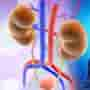 Best Kidney Transplant Hospitals in the World