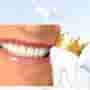 Most Desired Treatment of Dental Crowns in Cali, Colombia