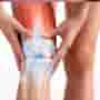 Top Benefits of Robotic Knee Replacement Surgery at Turan Turan Health Group in Turkey