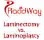 Laminectomy VS Laminoplasty Which One Is Best For Me?