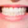 Is it Safe to Get Dental Implants in Costa Rica