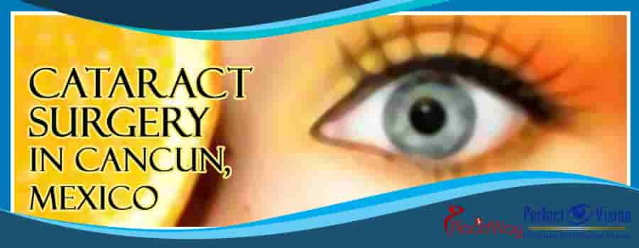 Perfect Vision Eye Lasik Surgery Center in Cancun, Mexico