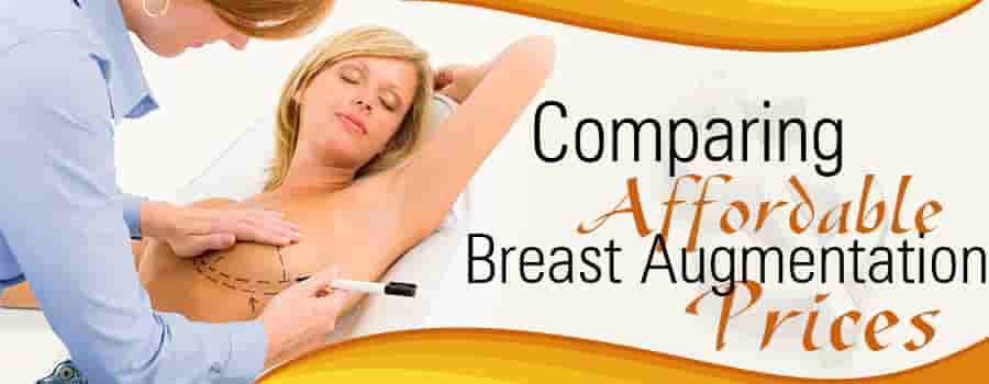 Affordable Breast Augmentation Price Comparison Guide