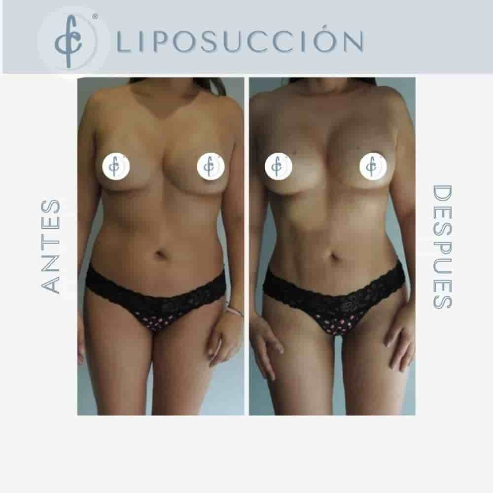 Dr. Felipe Castro Esguerra Plastic Surgery Reviews in Bogota, Colombia Slider image 4