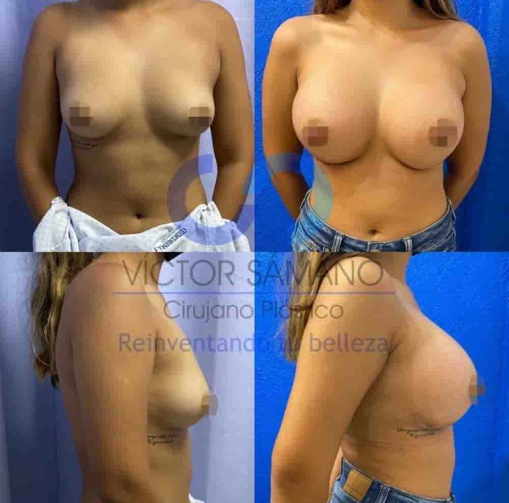 Dr Victor Samano Plastic Surgery Cancun Reviews in Cancun,Playa Del Carmen, Mexico Slider image 8