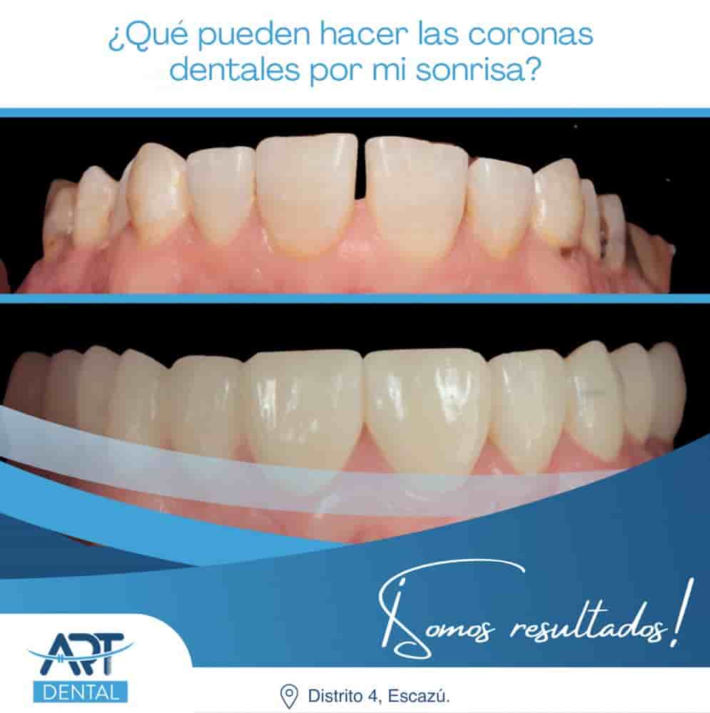 Art Dental Care in San José,Escazu, Costa Rica Reviews from Real Patients Slider image 10