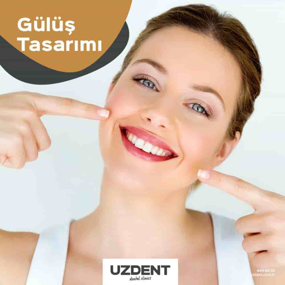 Uzdent Dental Clinics in Istanbul,Kayseri, Turkey Reviews from Real Patients Slider image 3