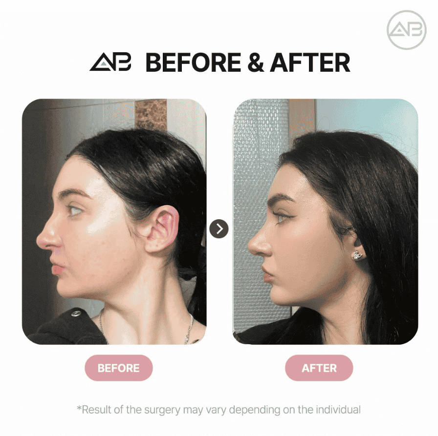 AB Plastic Surgery in Seoul, South Korea Reviews from Real Patients Slider image 2