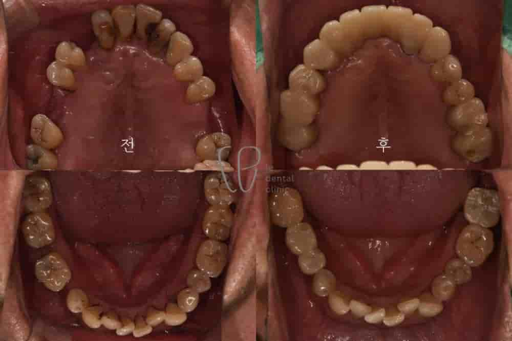 Le Dental Clinic in Seoul, South Korea Reviews from Real Patients Slider image 4