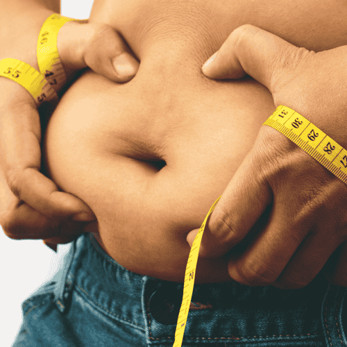 Gastric Bypass Surgery in Turkey 