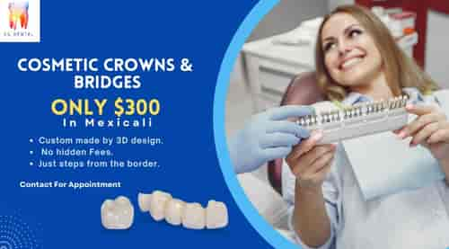 Cosmetic Crowns - Zirconia