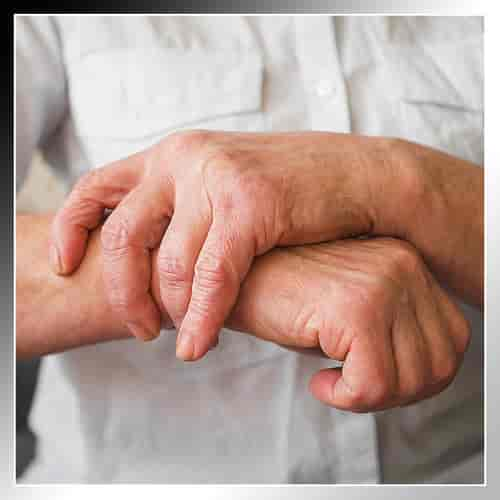 Stem Cell Therapy for Rheumatoid Arthritis in Cabo San Lucas