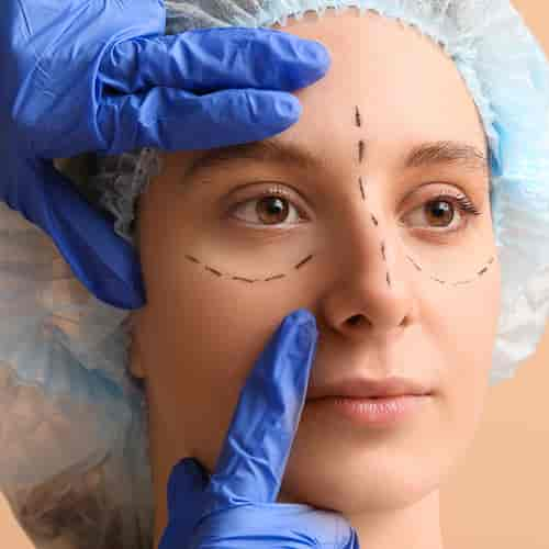 Eyelid Surgery Package in Tijuana, Mexico by AOFHN Clinic and OR