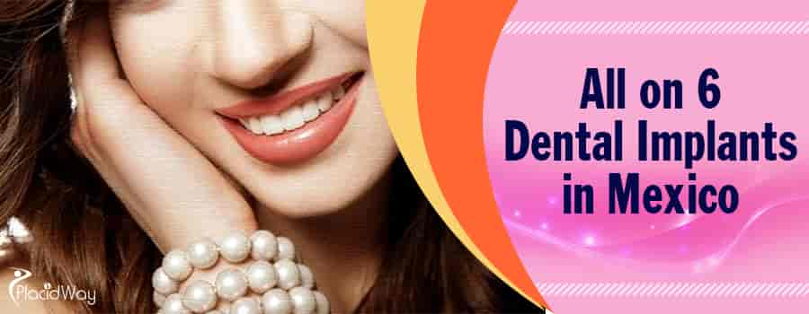 Why Pearl Dental & Implant Center - Pearl Dental & Implant Center