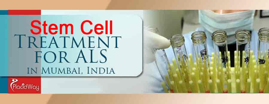 Stem cell therapy  Top Stem cell treatment centre in India