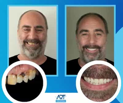 Art Dental Care   Dental Clinic In San Jose Costa Rica Image