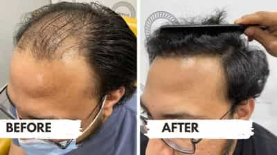 Zeeva Skin &amp; Hair Clinic In Ahmedabad, Gujarat, India Image