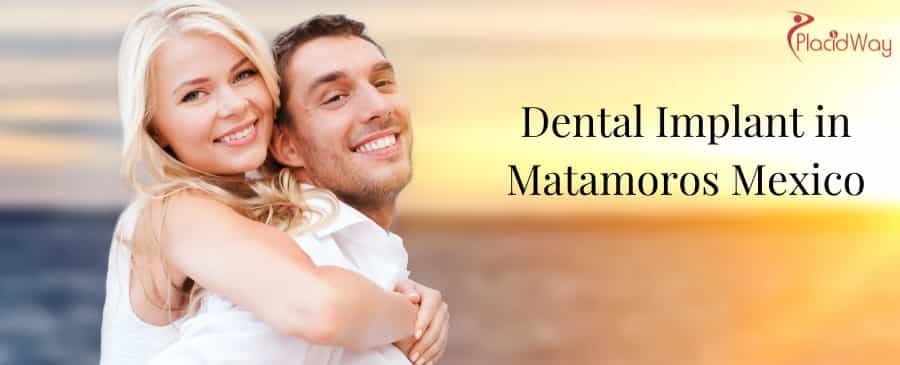 Dental Implant in Matamoros Mexico