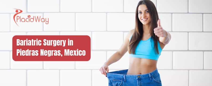 Bariatric Surgery in Piedras Negras, Mexico