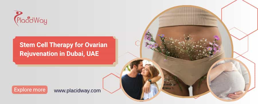 Stem Cell Therapy for Ovarian Rejuvenation in Dubai, UAE thumbnail