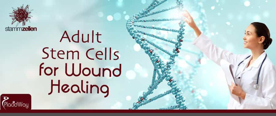 Stem Cell Treatment Packages Vienna Austria