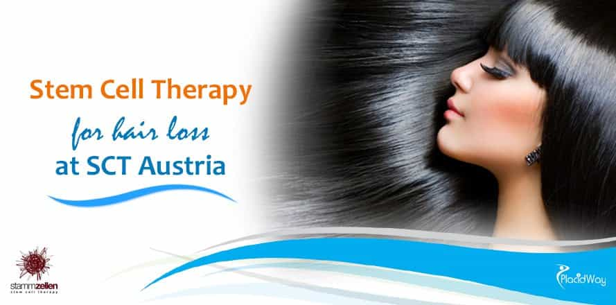 Live Cell Therapy, Hair Loss Treatment, SCT Austria, Vienna