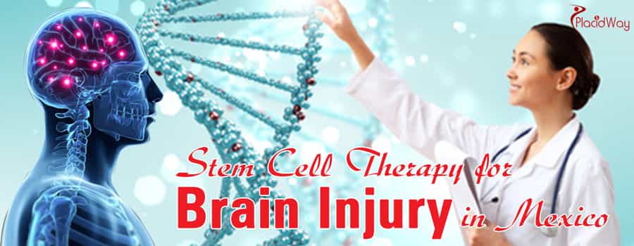 Stem Cell Therapy for Brain Injury in Mexico