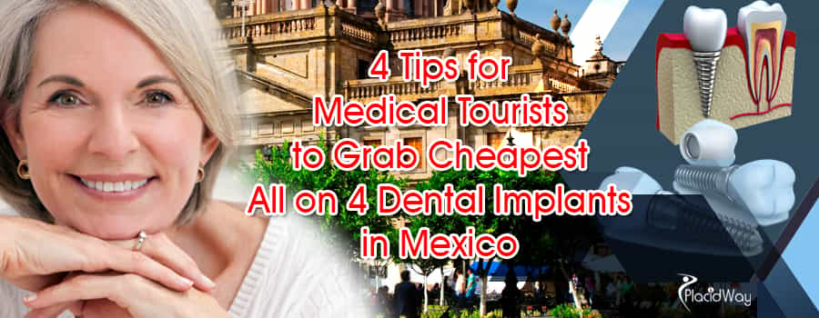 All on 4 Dental Implant in Mexico