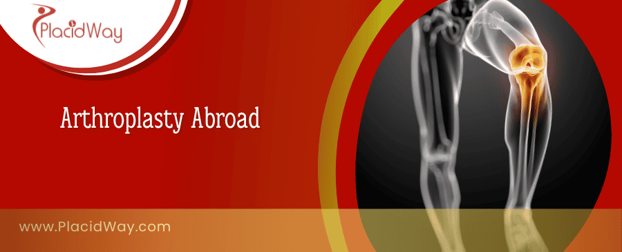 Arthroplasty Abroad