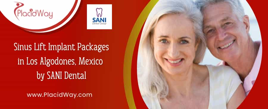 Sinus Lift Implant in Los Algodones, Mexico by SANI Dental