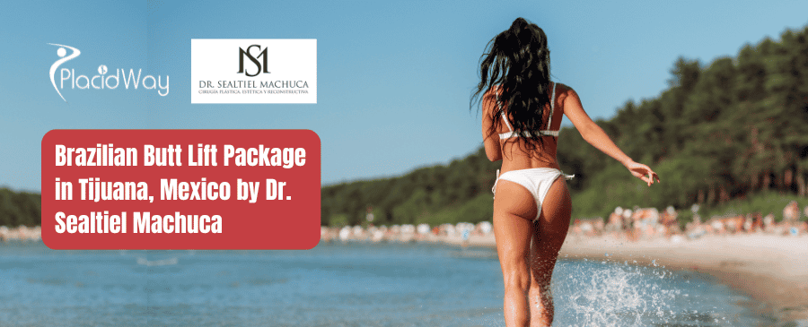 Brazilian Butt Lift Package in Tijuana, Mexico by Dr. Sealtiel Machuca