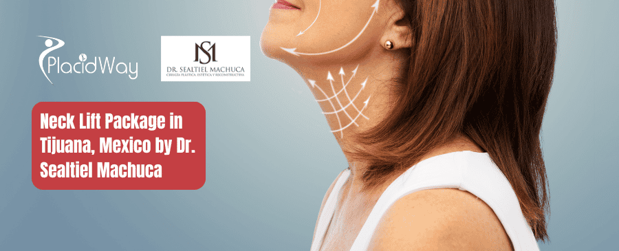 Neck Lift Package in Tijuana, Mexico by Dr. Sealtiel Machuca