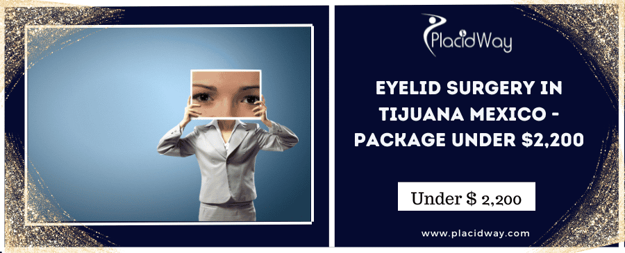 Eyelid Surgery in Tijuana