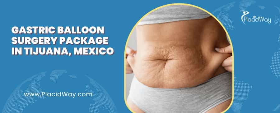 Gastric Balloon Surgery Package in Tijuana, Mexico
