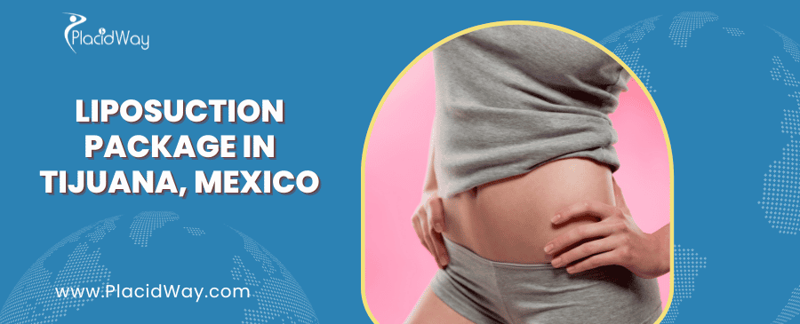 Liposuction in Tijuana