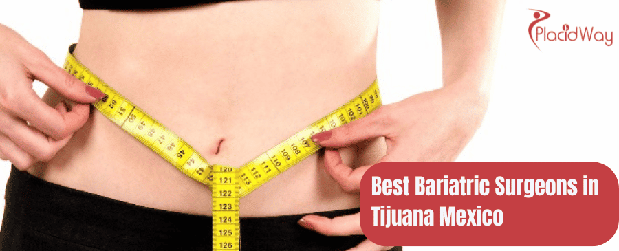 Best Bariatric Surgeons in Tijuana Mexico