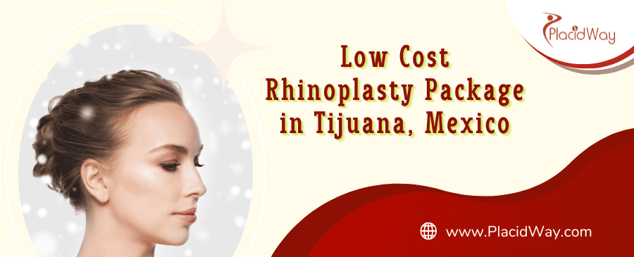 Rhinoplasty in Tijuana