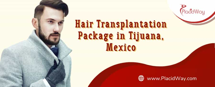 Hair Transplant Surgery Package in Tijuana Mexico