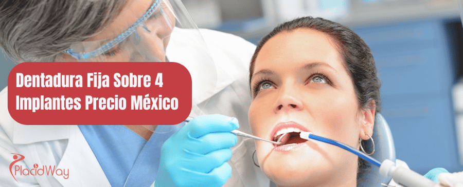 Dentadura Fija Sobre 4 Implantes Precio Mexico