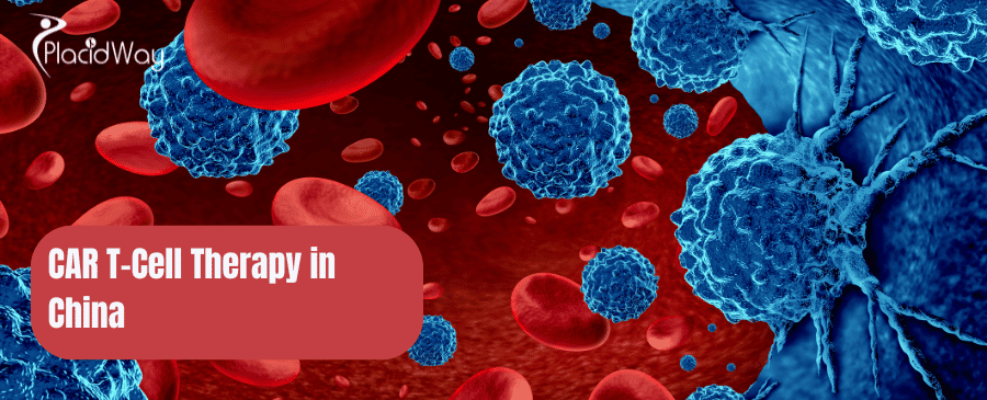 CAR T-Cell Therapy in China