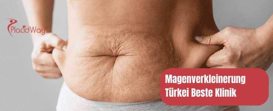 Magenverkleinerung Türkei Beste Klinik