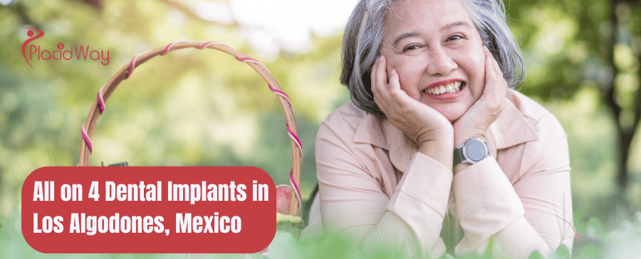 All on 4 Dental Implants in Los Algodones, Mexico