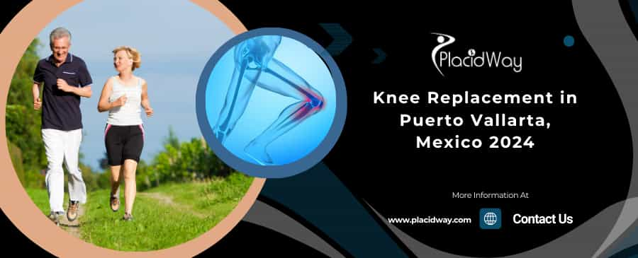 Knee Replacement in Puerto Vallarta, Mexico 2024