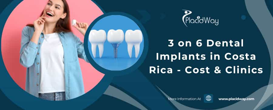 3 on 6 dental implants costa rica