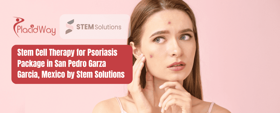 Stem Cell Therapy for Psoriasis Package in San Pedro Garza Garcia, Mexico by Stem Solutions