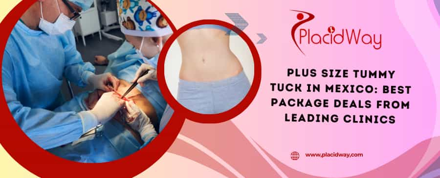 Plus Size Tummy Tuck in Mexico: Best Package Deals from Leading Clinics