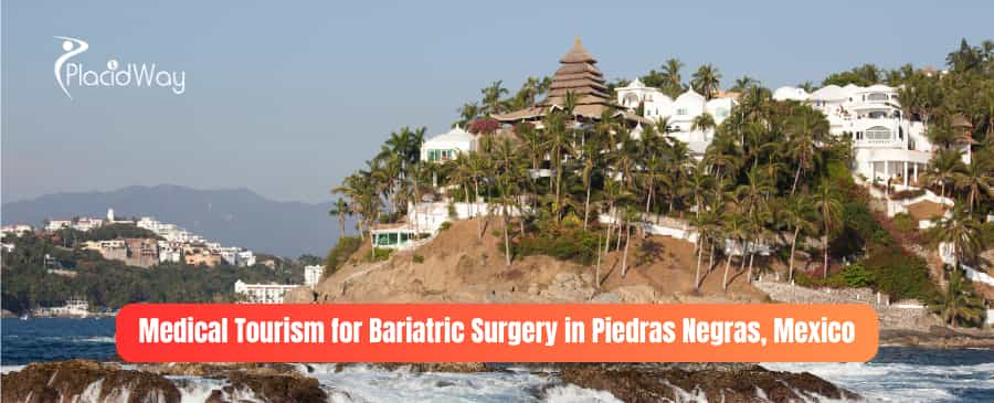 Medical Tourism for Bariatric Surgery in Piedras Negras, Mexico